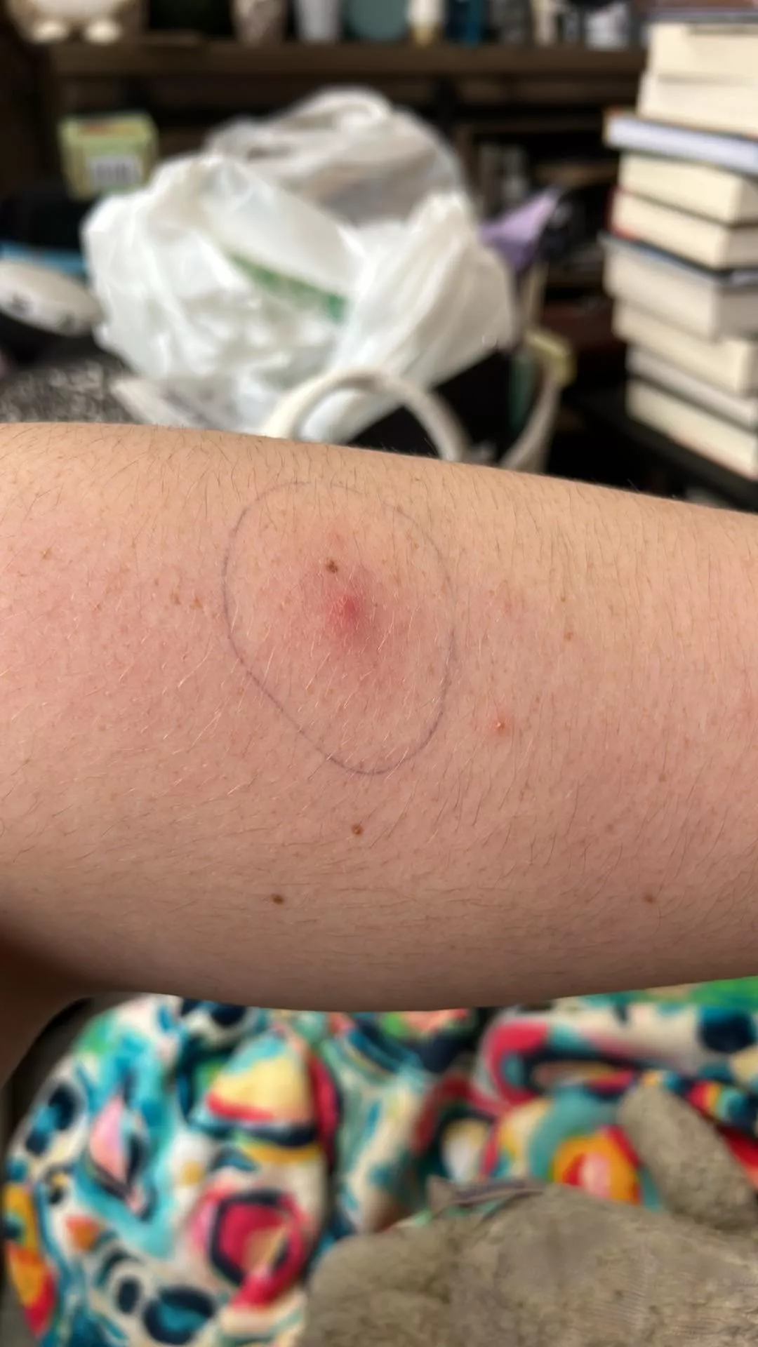 Now.. The Waiting Game 