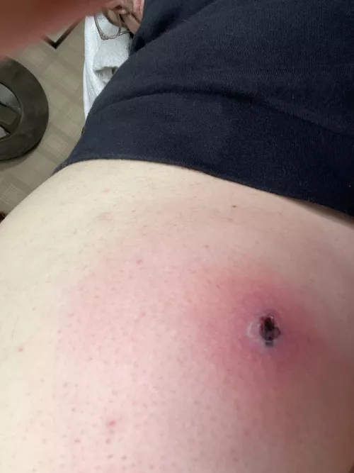 Will this pop? What is it?