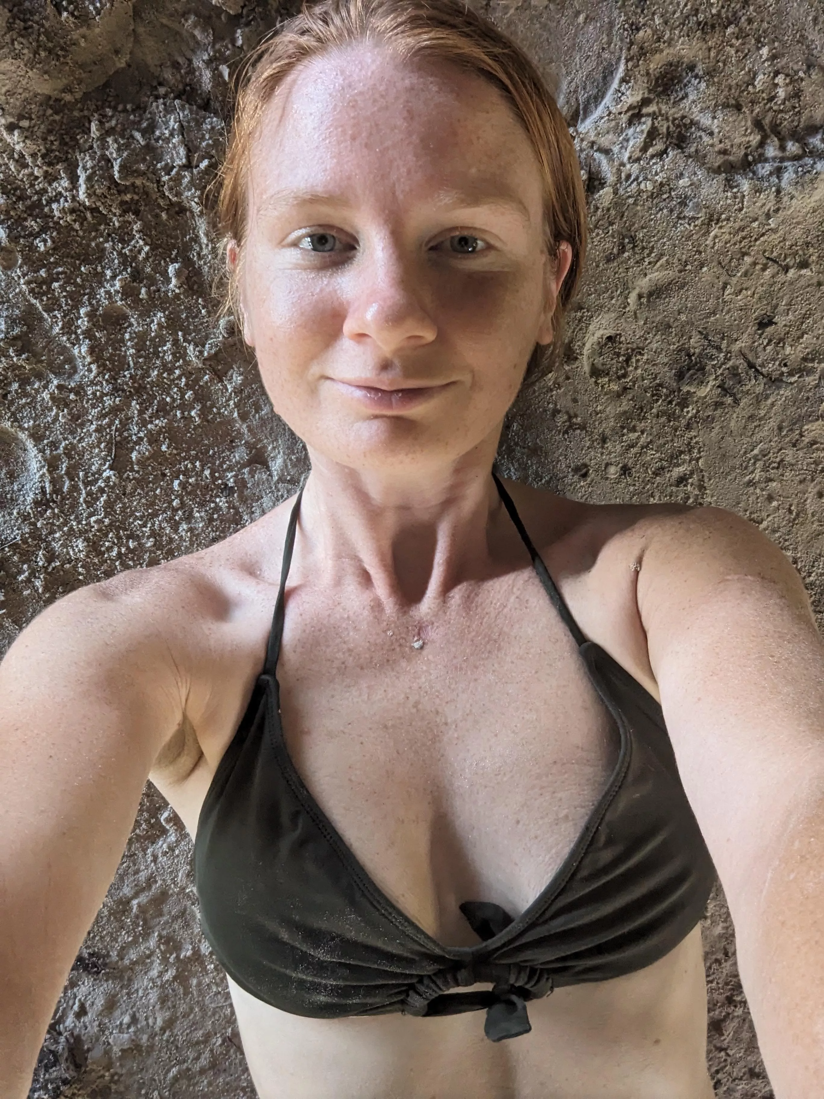 Freckles and finesse