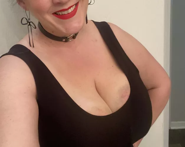 I love showing off my bruises!