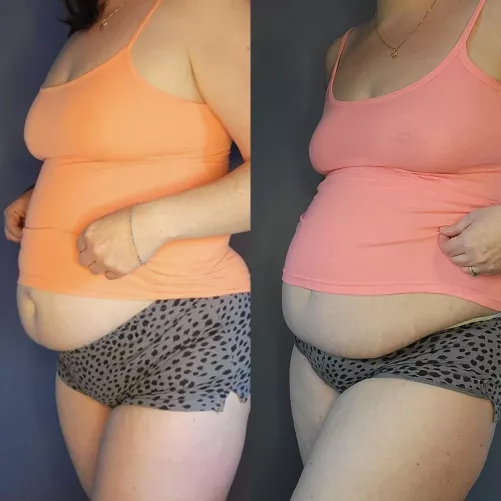 I've definitely been stuffing myself well😅