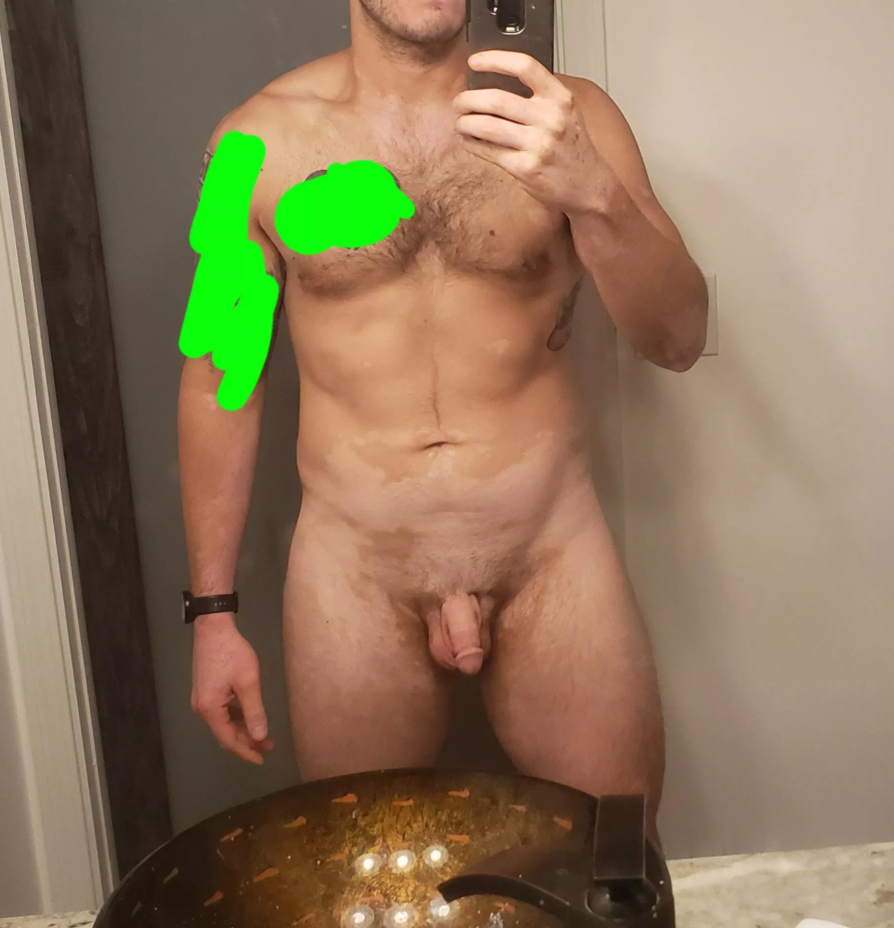 Let (m)e know? Vitiligo