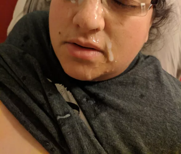 My eyes were glued shut 