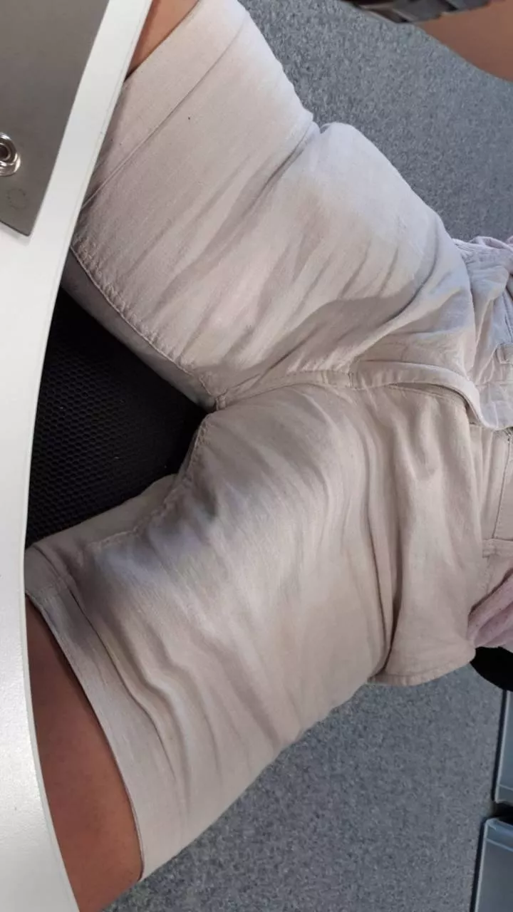 Should I keep wearing white shorts?