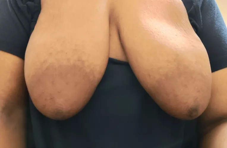 the biggest and puffiest on here for sure  :)