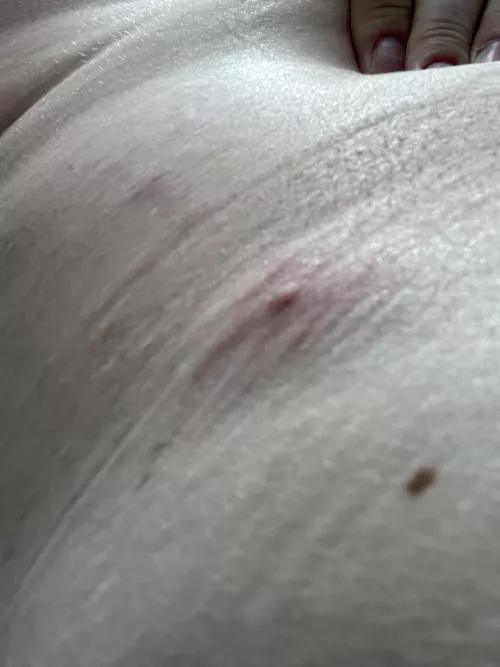 waistband monster is starting to show it's head. I wish these weren't so deep. it'd be nice to pop it and get it over with.