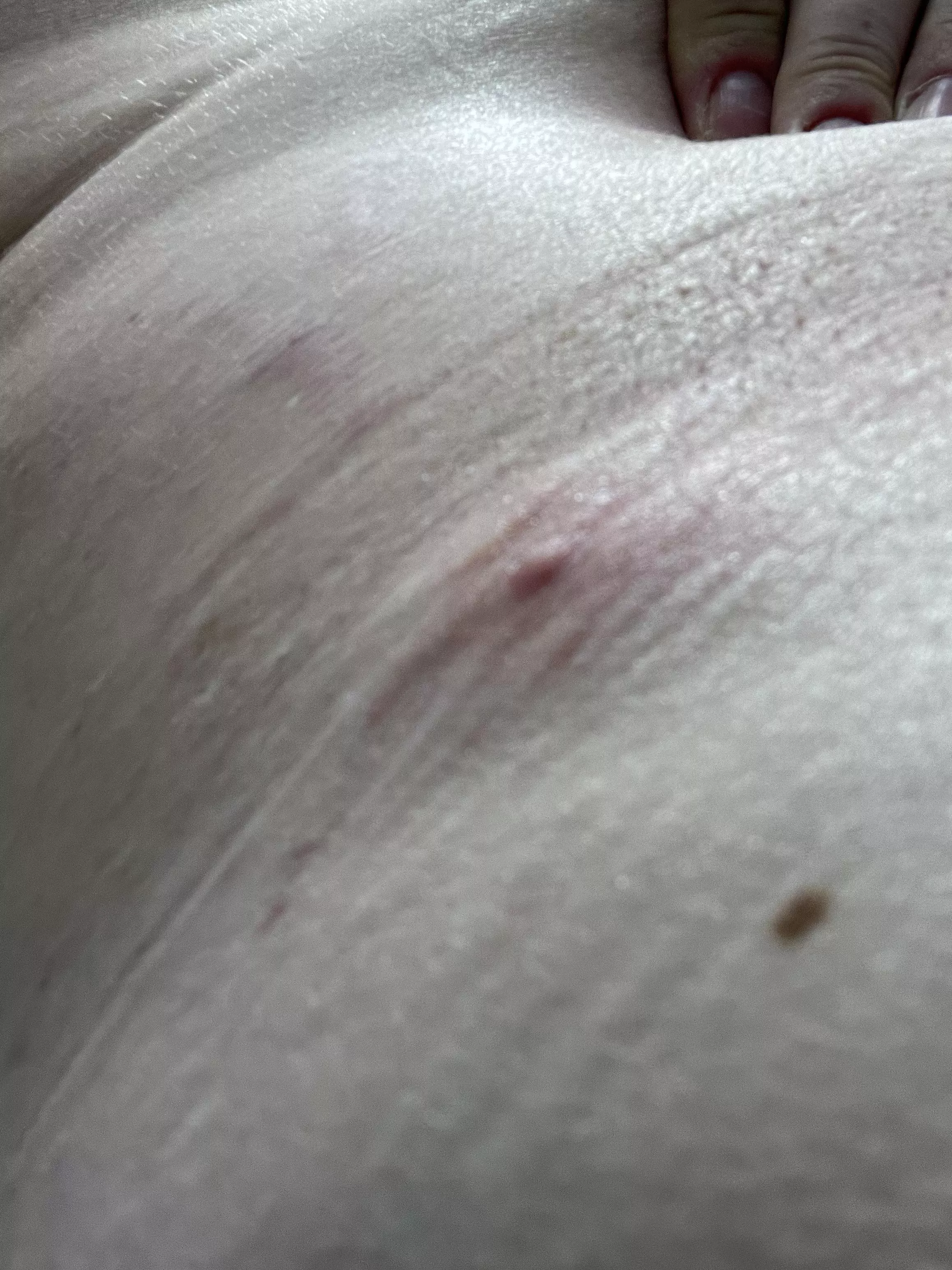 waistband monster is starting to show it's head. I wish these weren't so deep. it'd be nice to pop it and get it over with.