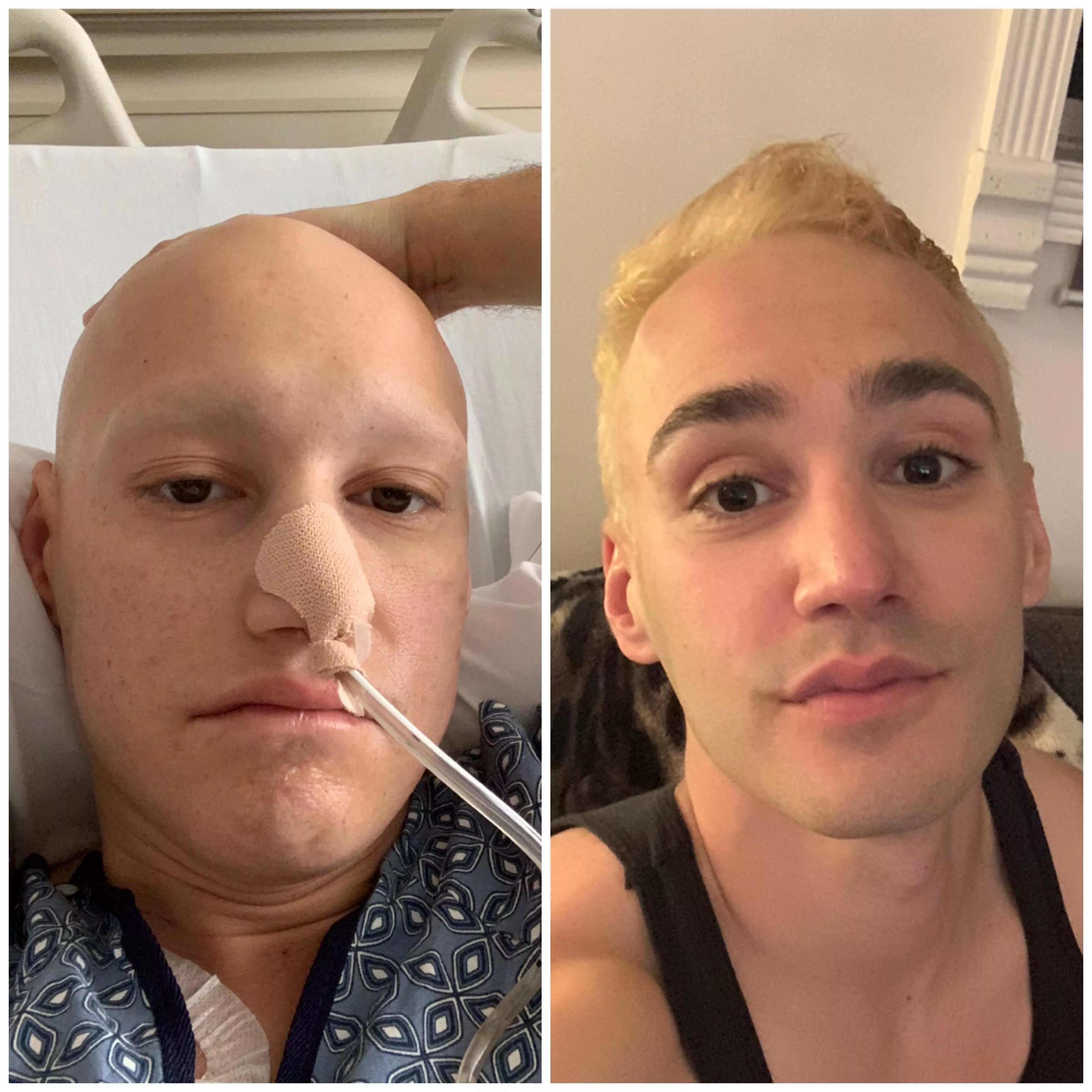 A year after my last chemo and I can finally say Im back to my old self (well...with a blonde upgrade ) #cancersurvivor