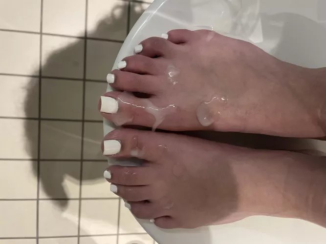 Do you want to know how this happened to my 18 year old feet 🤭