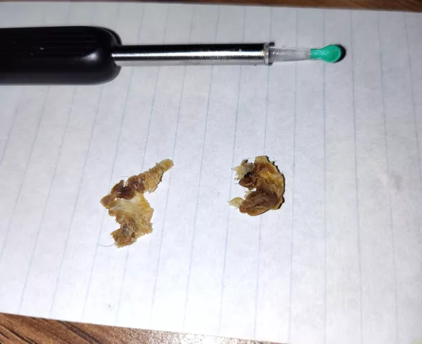 Ear gunk removed! Best $5 I have ever spent lol