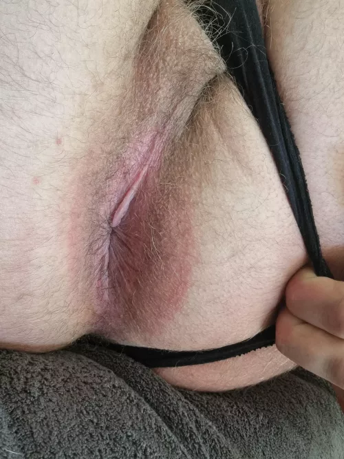 Hair is starting to come back 