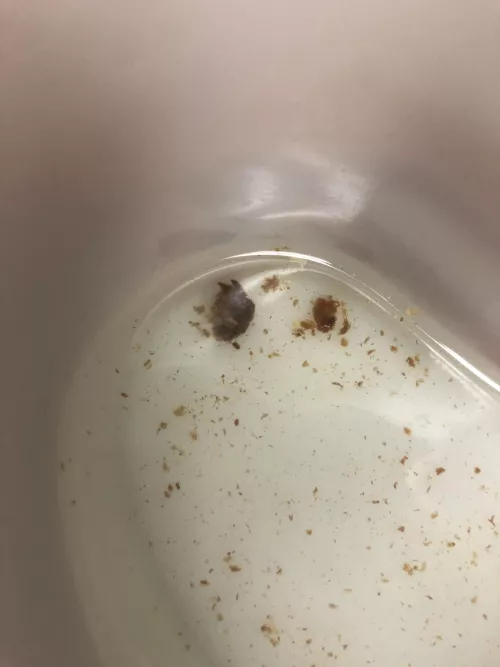 My ear was clogged for days so I had my ear flushed and this came out 🤢