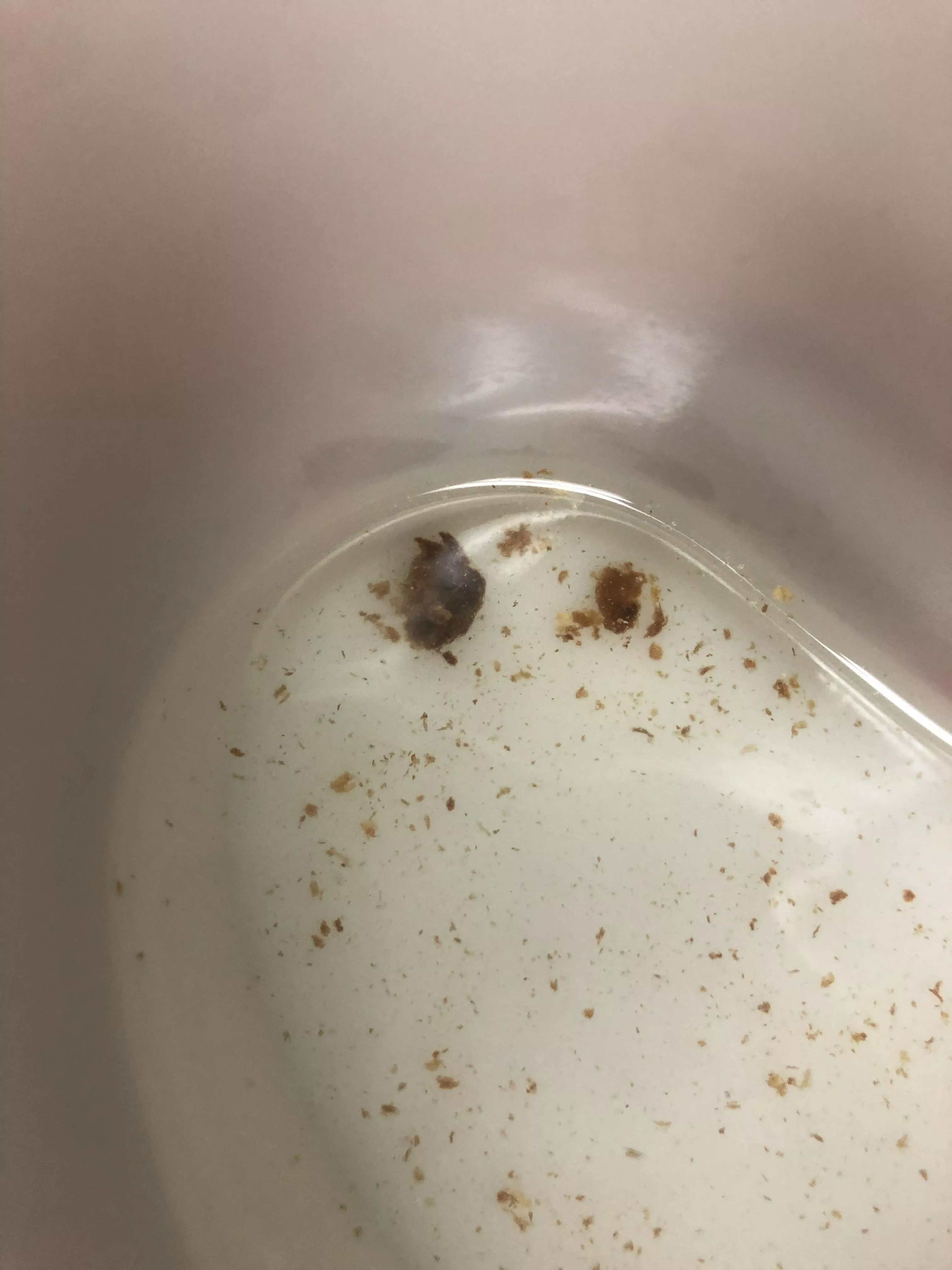 My ear was clogged for days so I had my ear flushed and this came out 🤢