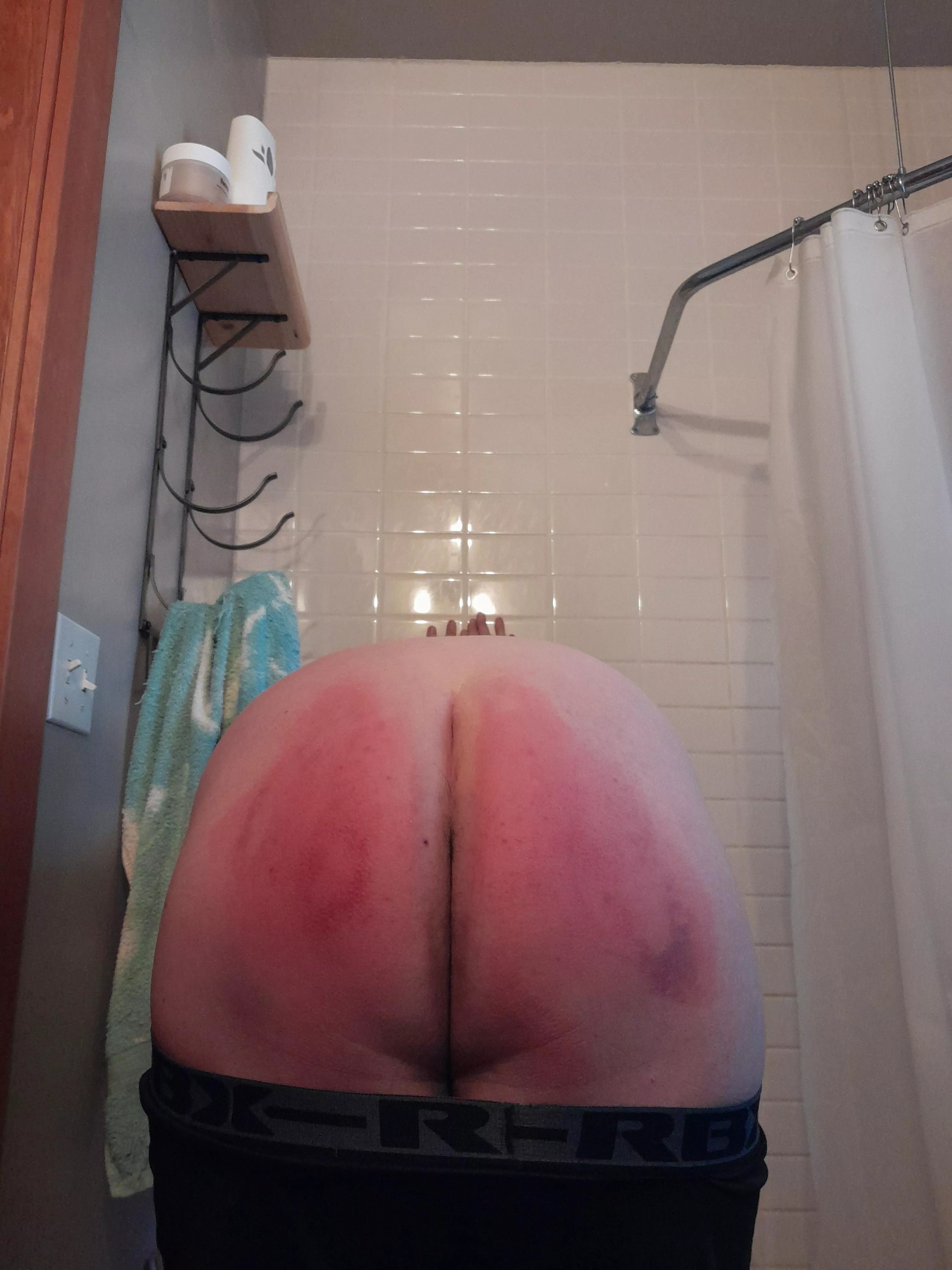 Aftermath from my wife/dom punishing me with her paddle 