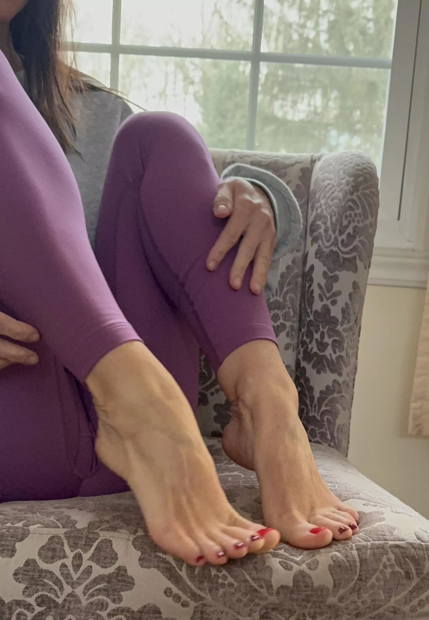 Do my high arches make my feet look weird