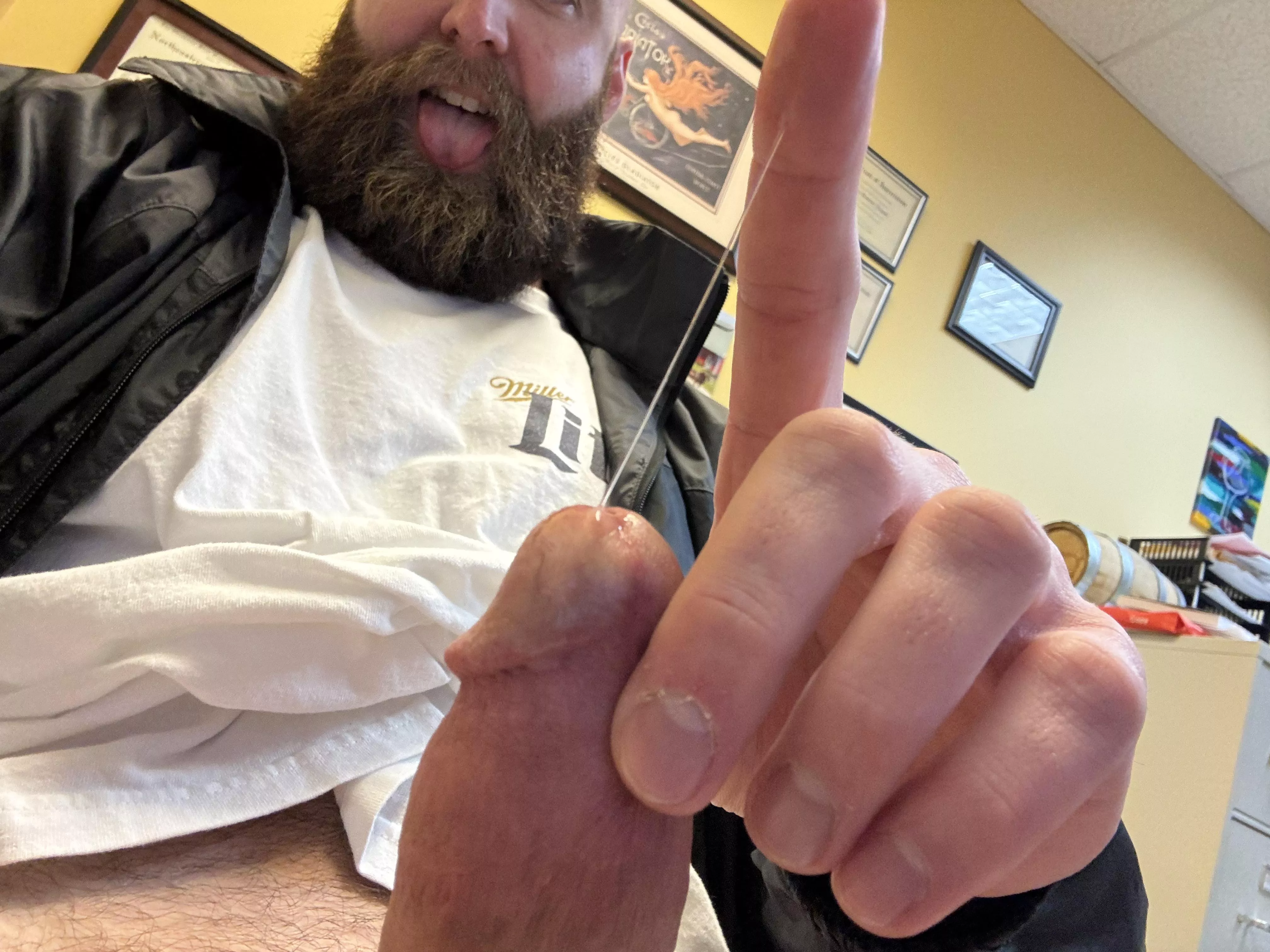 Drip from the tip [34]