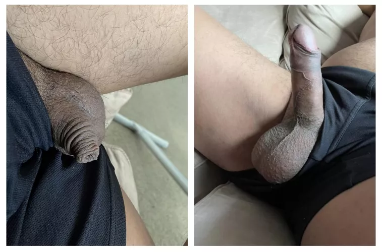 When I'm soft I'm just foreskin. What a difference 😅
