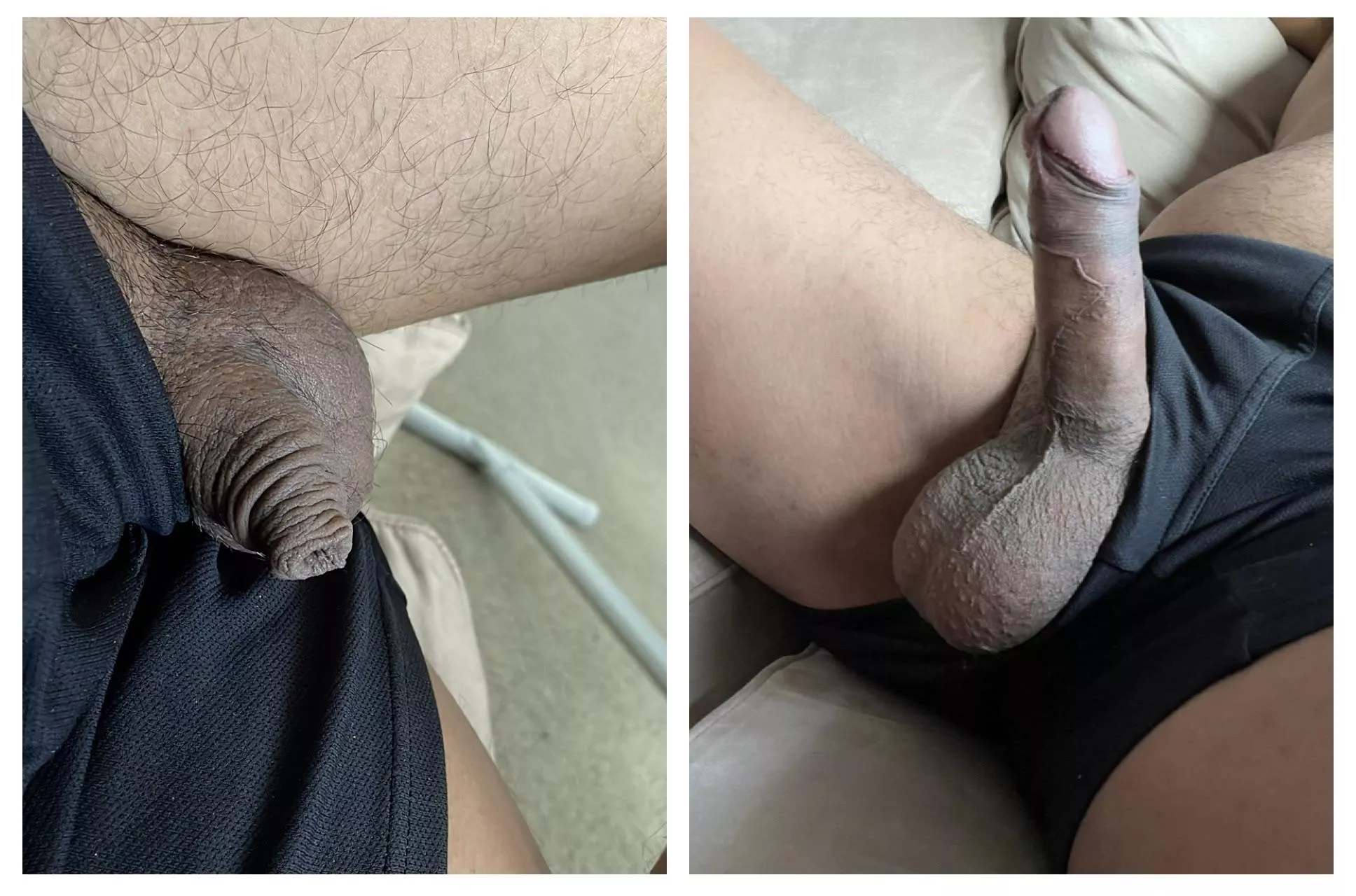When I'm soft I'm just foreskin. What a difference 😅