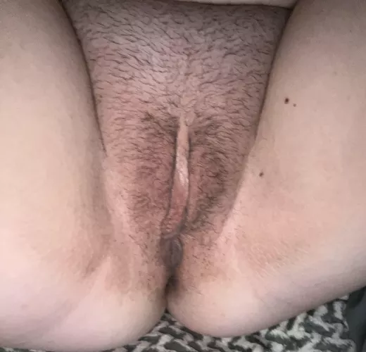 Documenting growing her back out for summer. Day 3