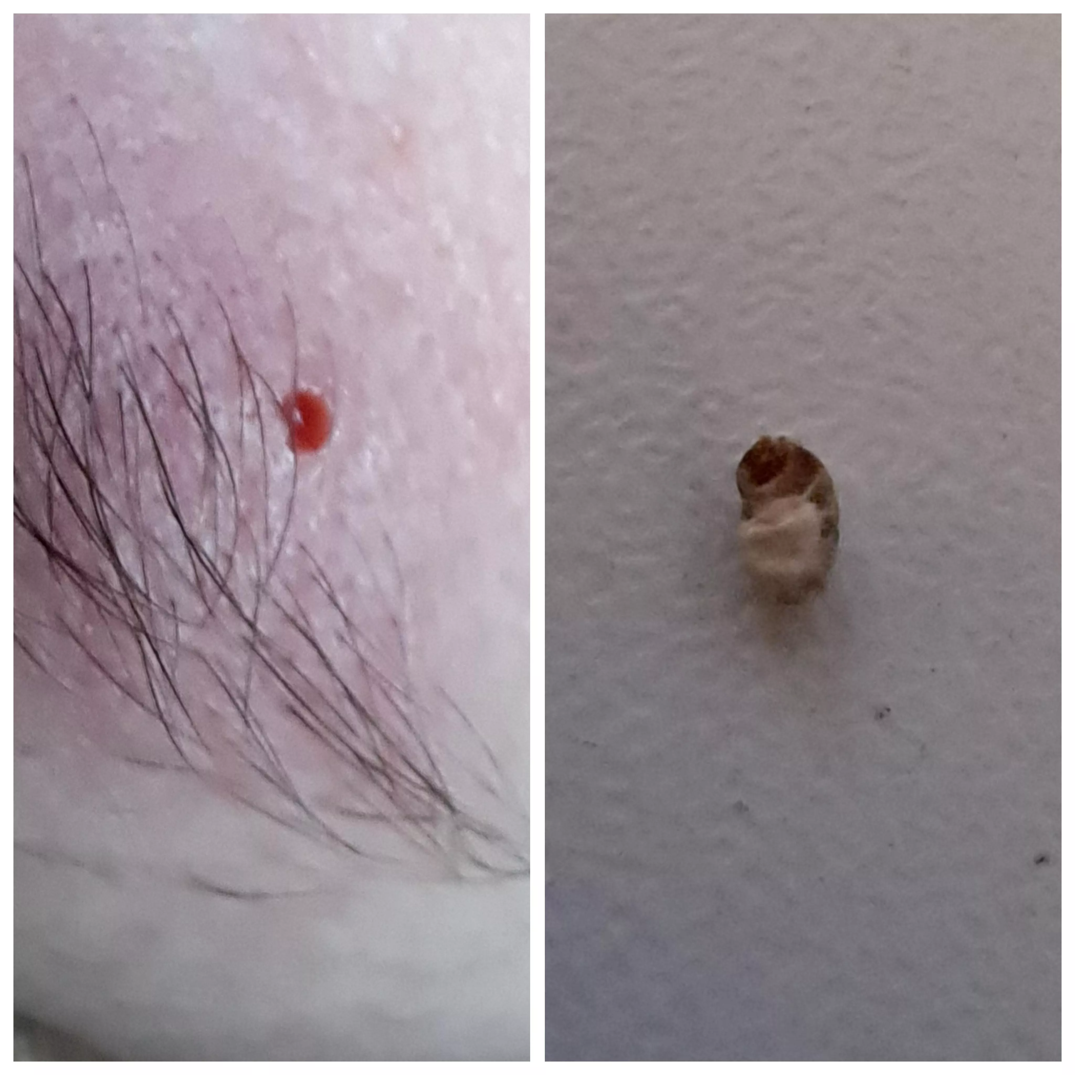 Eyebrow pore of Winer