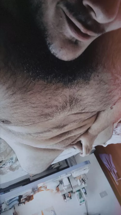 Surprise attack 👀