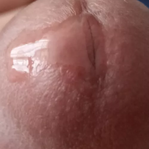 Close precum