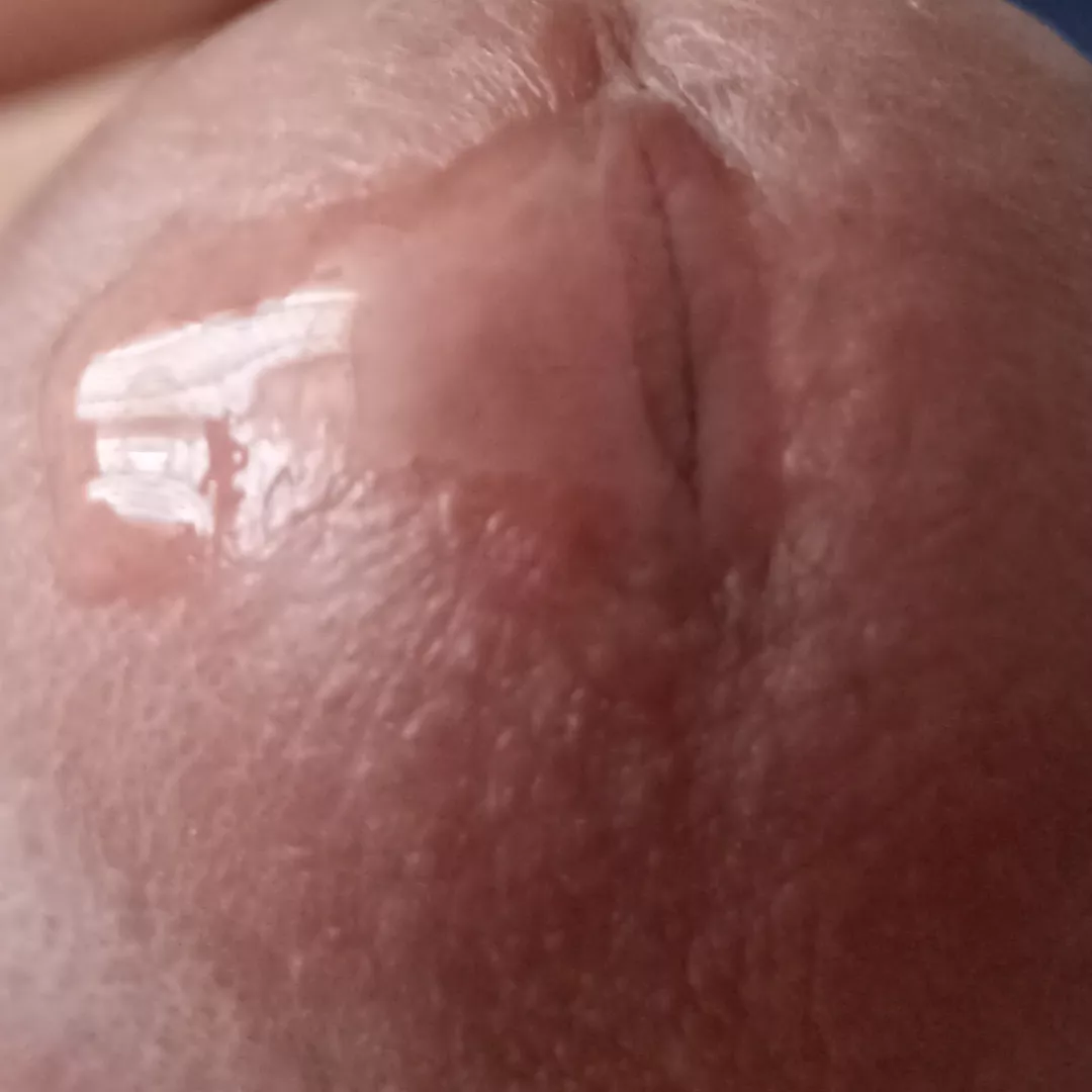 Close precum