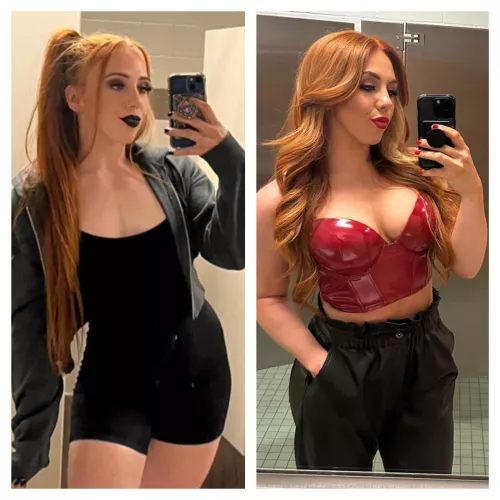 Isla Dawn Before/After Boob Job