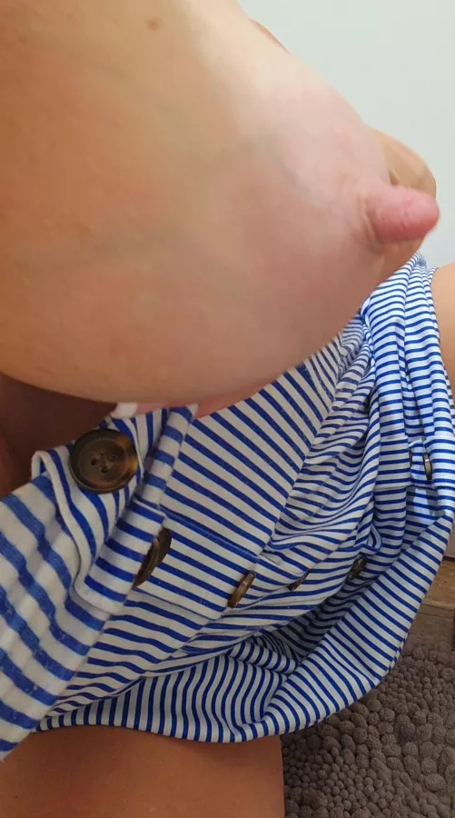 My beautiful veins go with my dress today