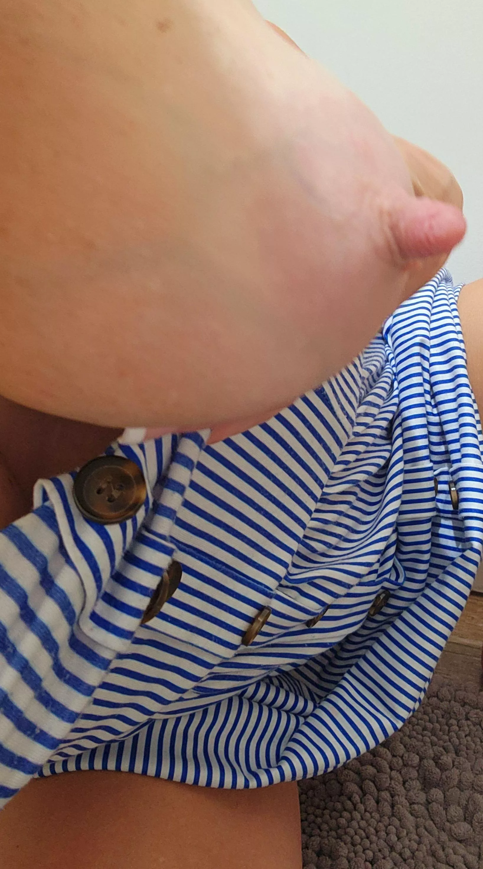 My beautiful veins go with my dress today