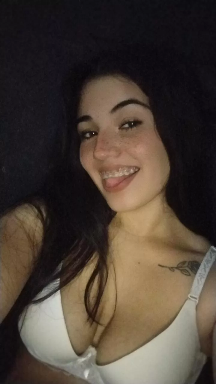 Selfie in mi braces 😋