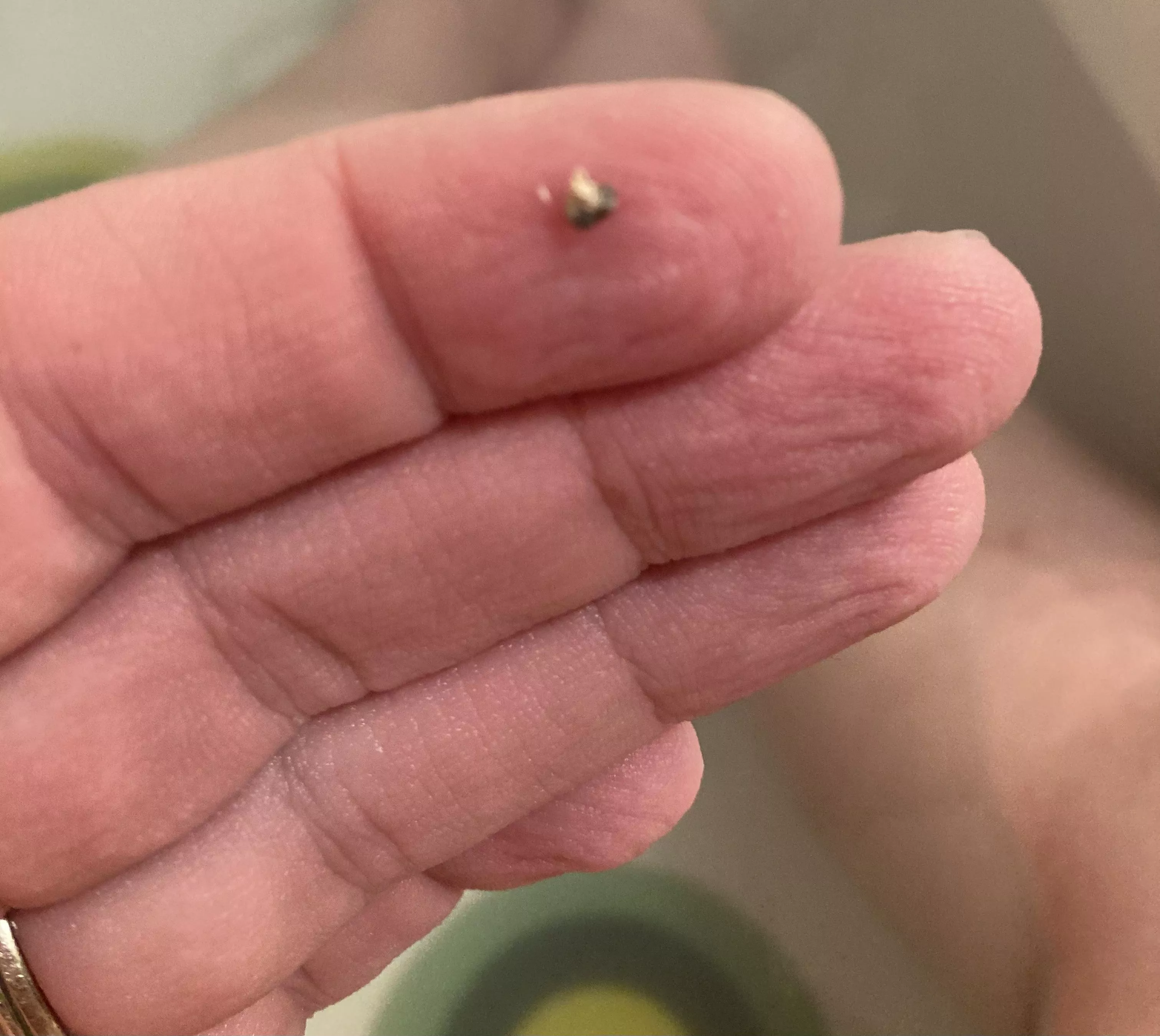 Foreign object (?) from my leg