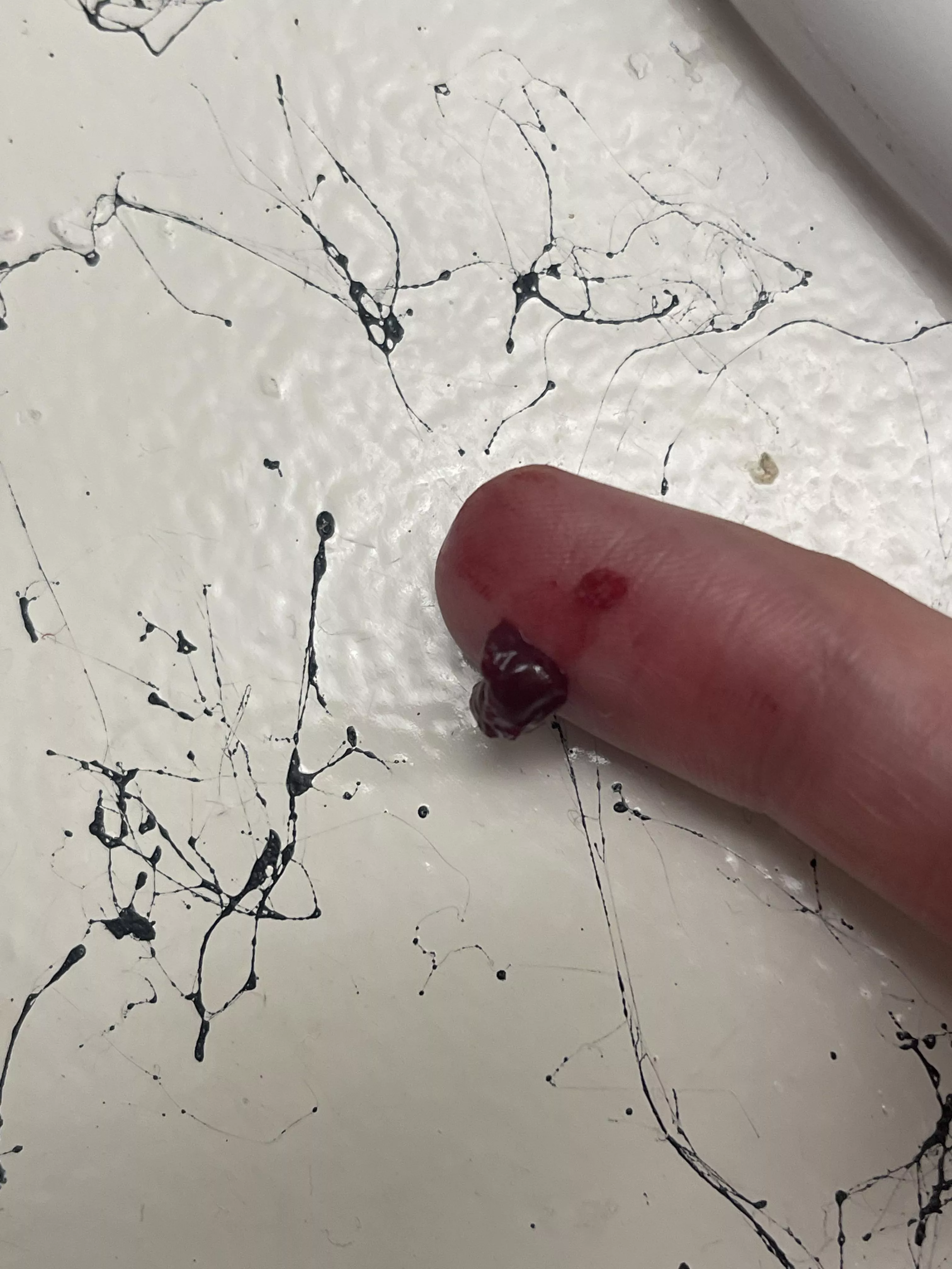 Super painful temple abscess