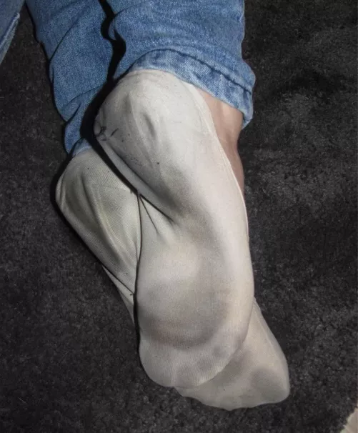 Very old ‘n well worn peds!