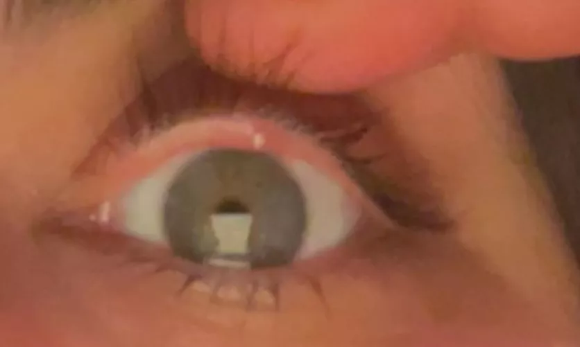 Why is this one so painful?