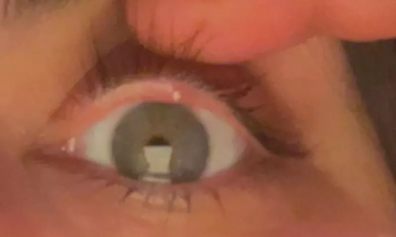 Why is this one so painful?