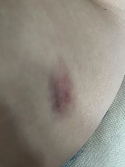 Your sign to wait til it’s ready and make an opening…