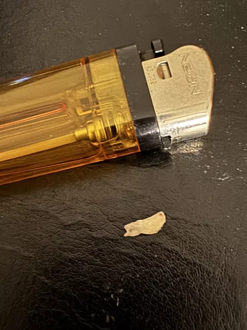 Huge Bone shard 2 years after wisdom tooth extraction