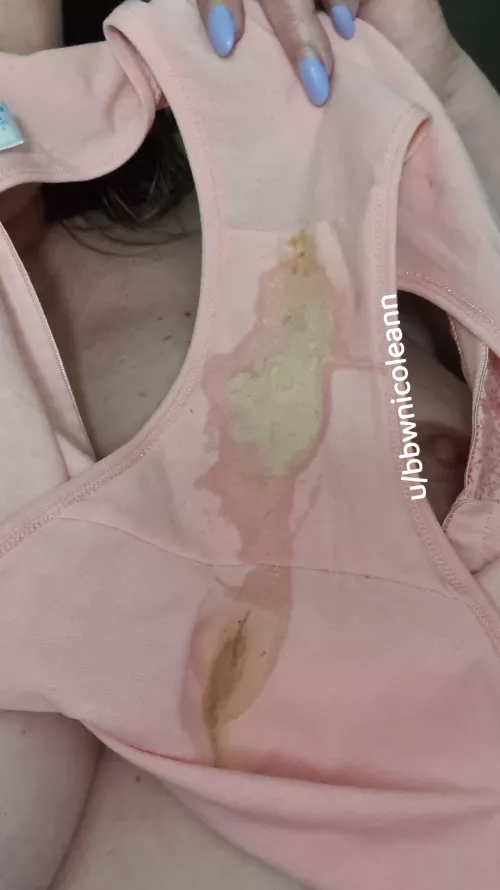 So much discharge and the skids.