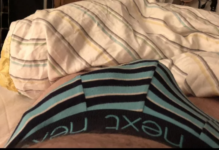 Trying to hide this when out is a nightmare.