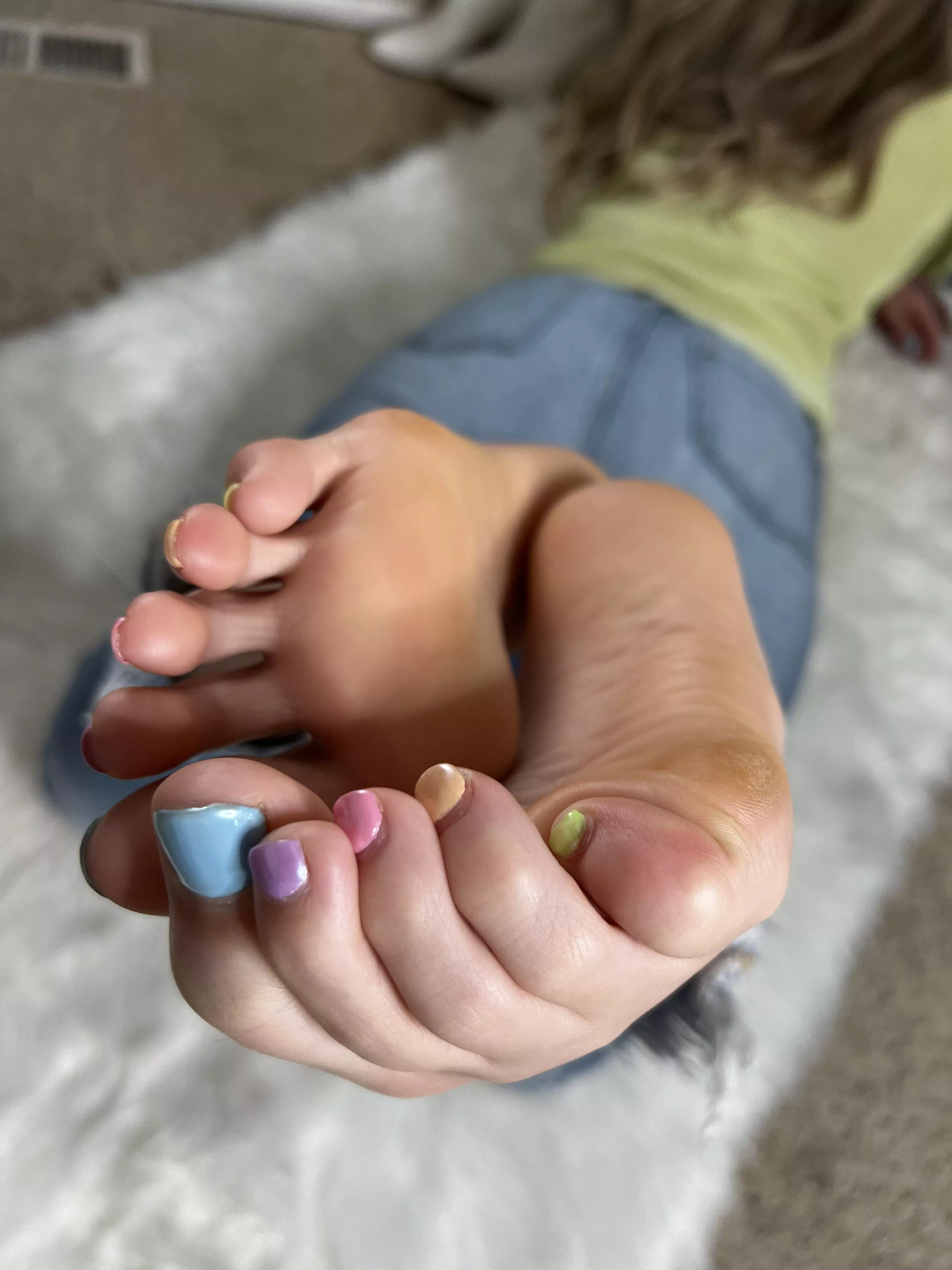 A closer look at the top and bottom of my toes! 