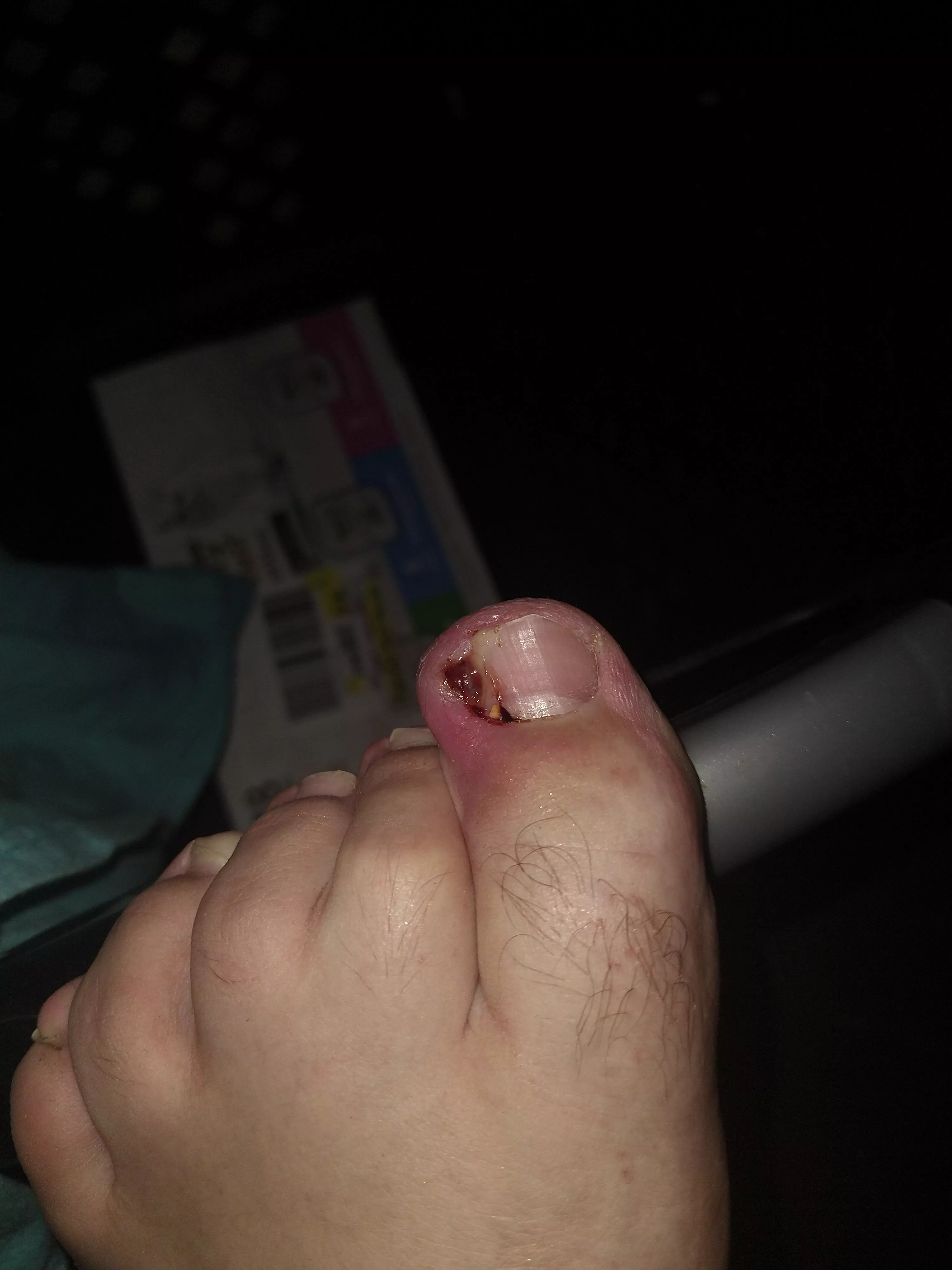 Figured you weirdos, (me included) might want to see this