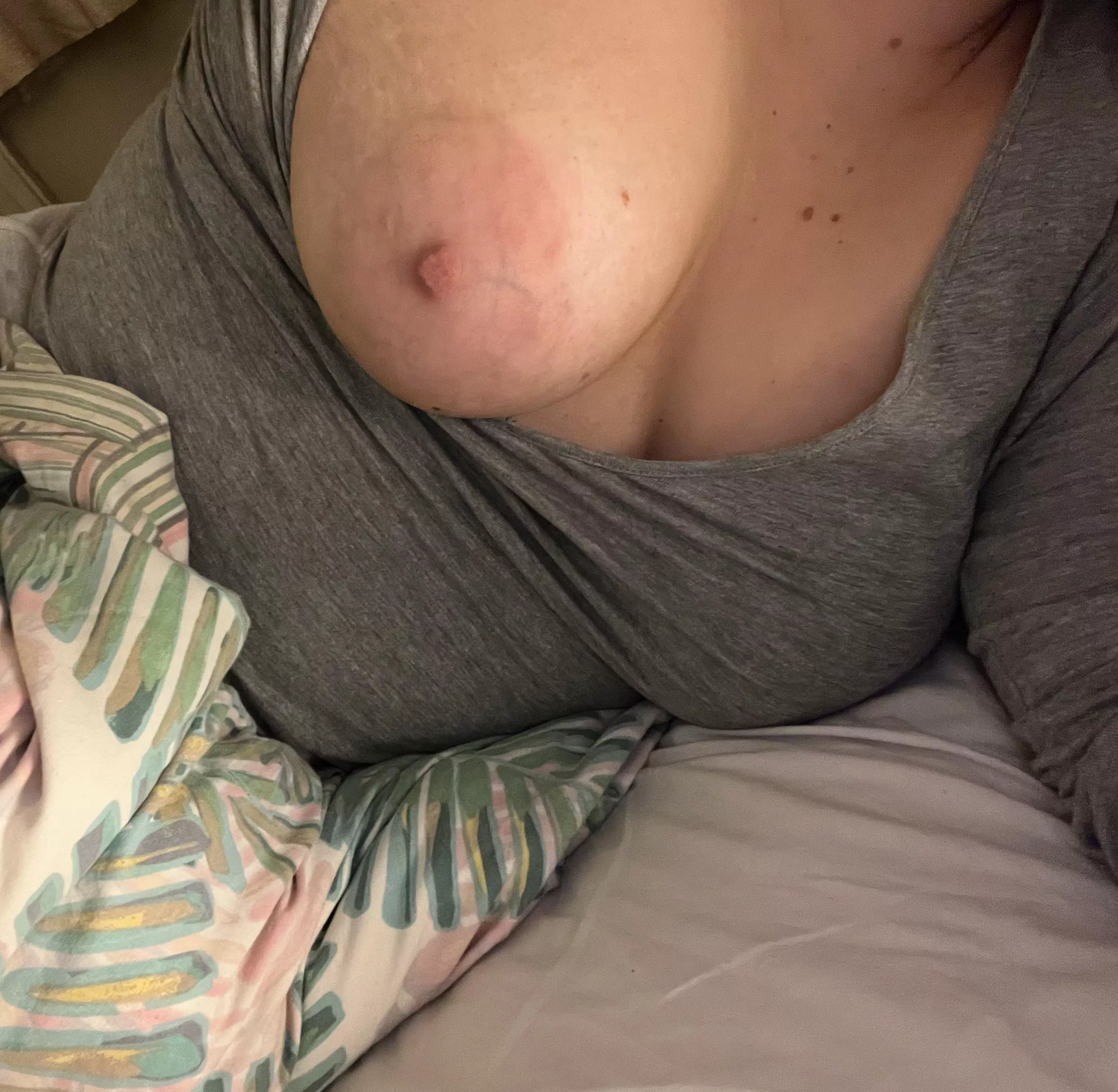 My biggest insecurities 😩