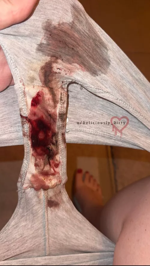 Talk about a bloody surprise!