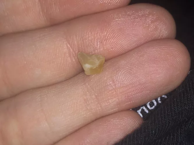 this just fell out of my nose