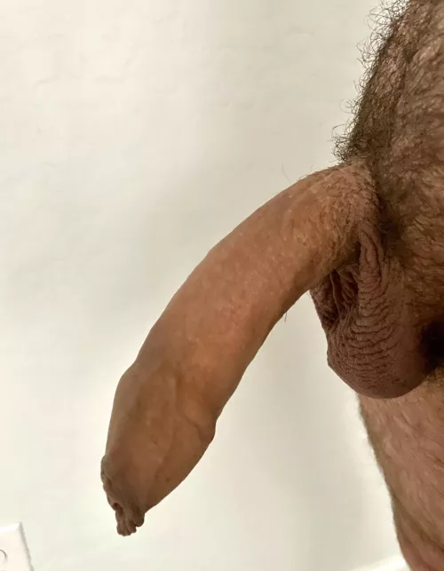 (44) Proud of my foreskin