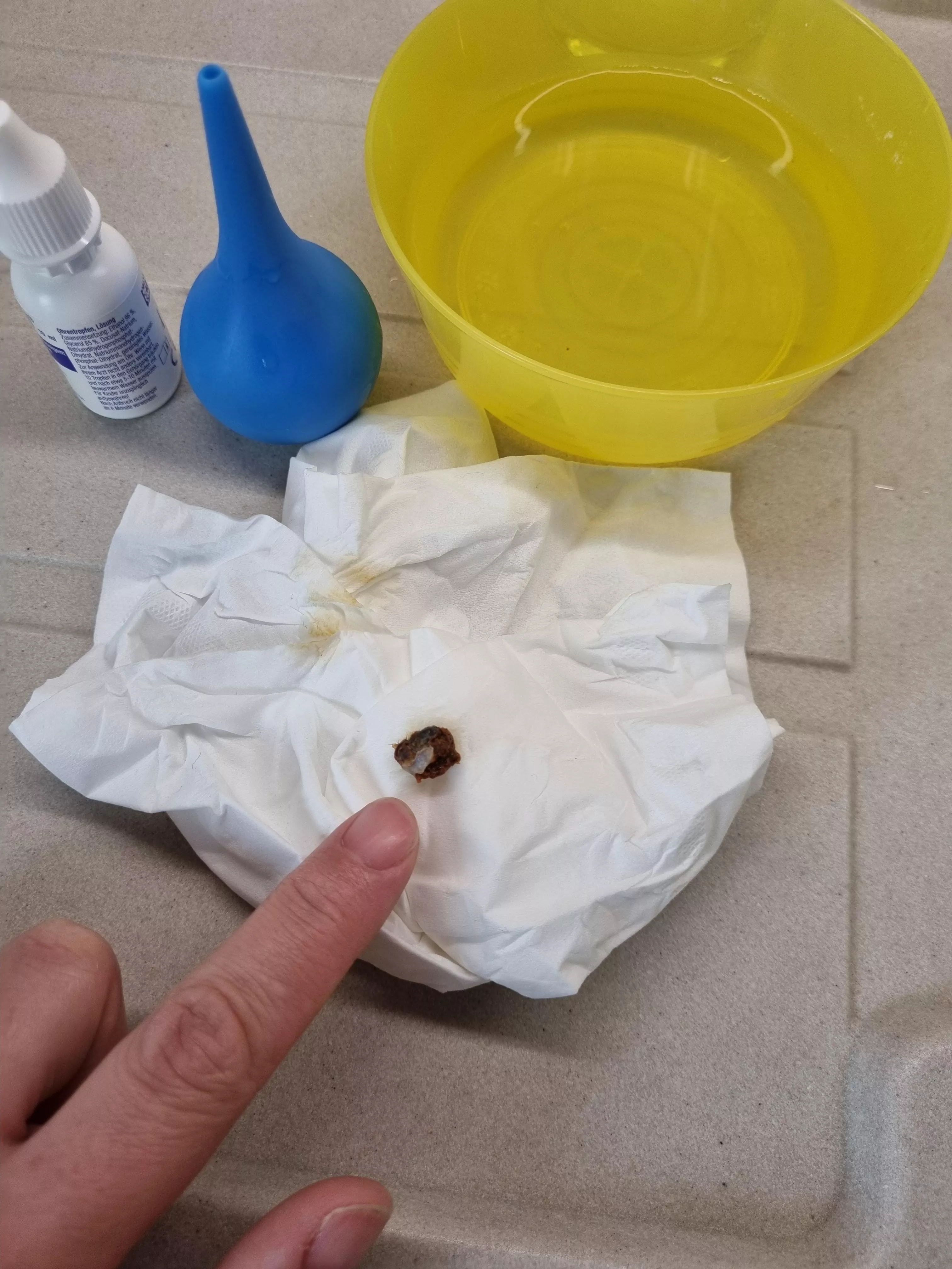 Rinsed out of my ear, everything was suddenly so loud