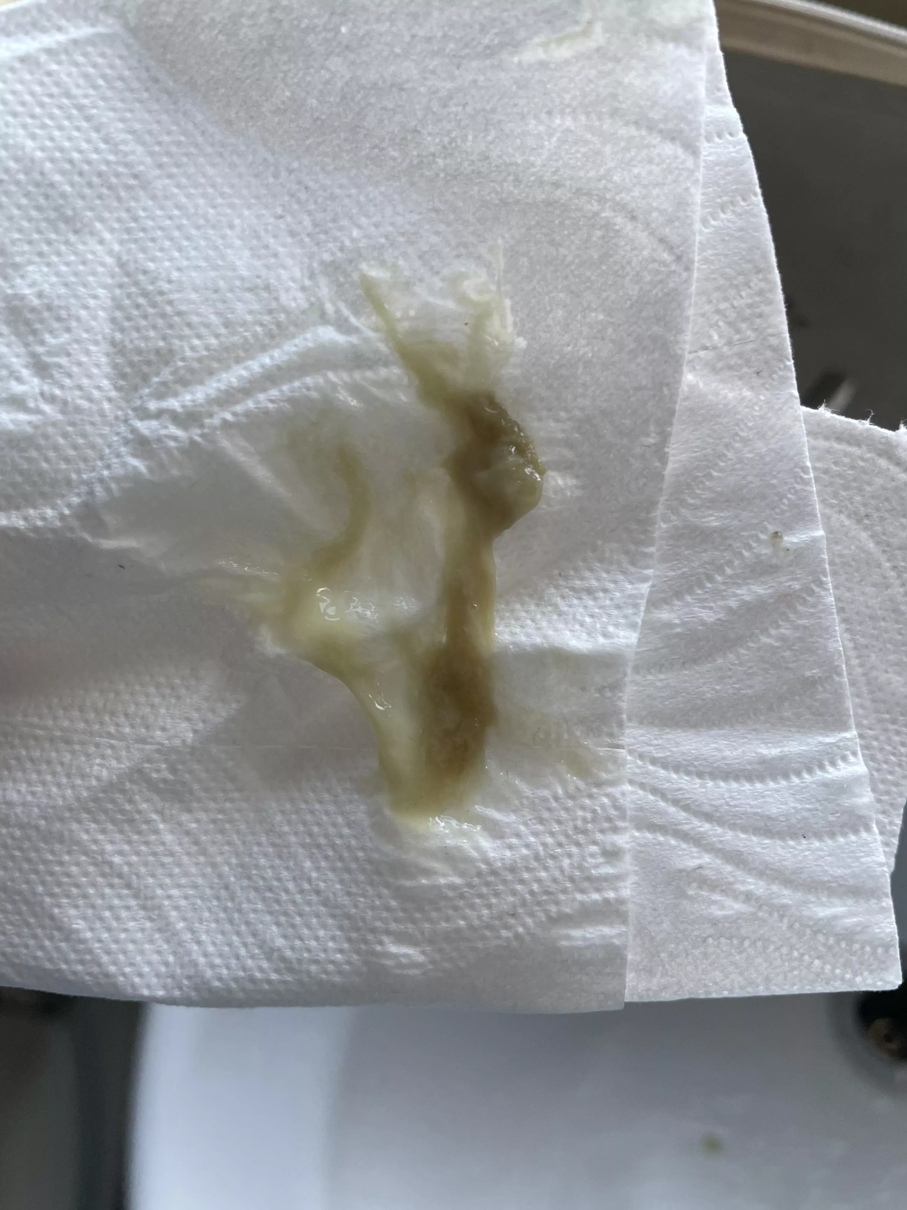 This practically crawled out my nose after a 3 month sinus infection 