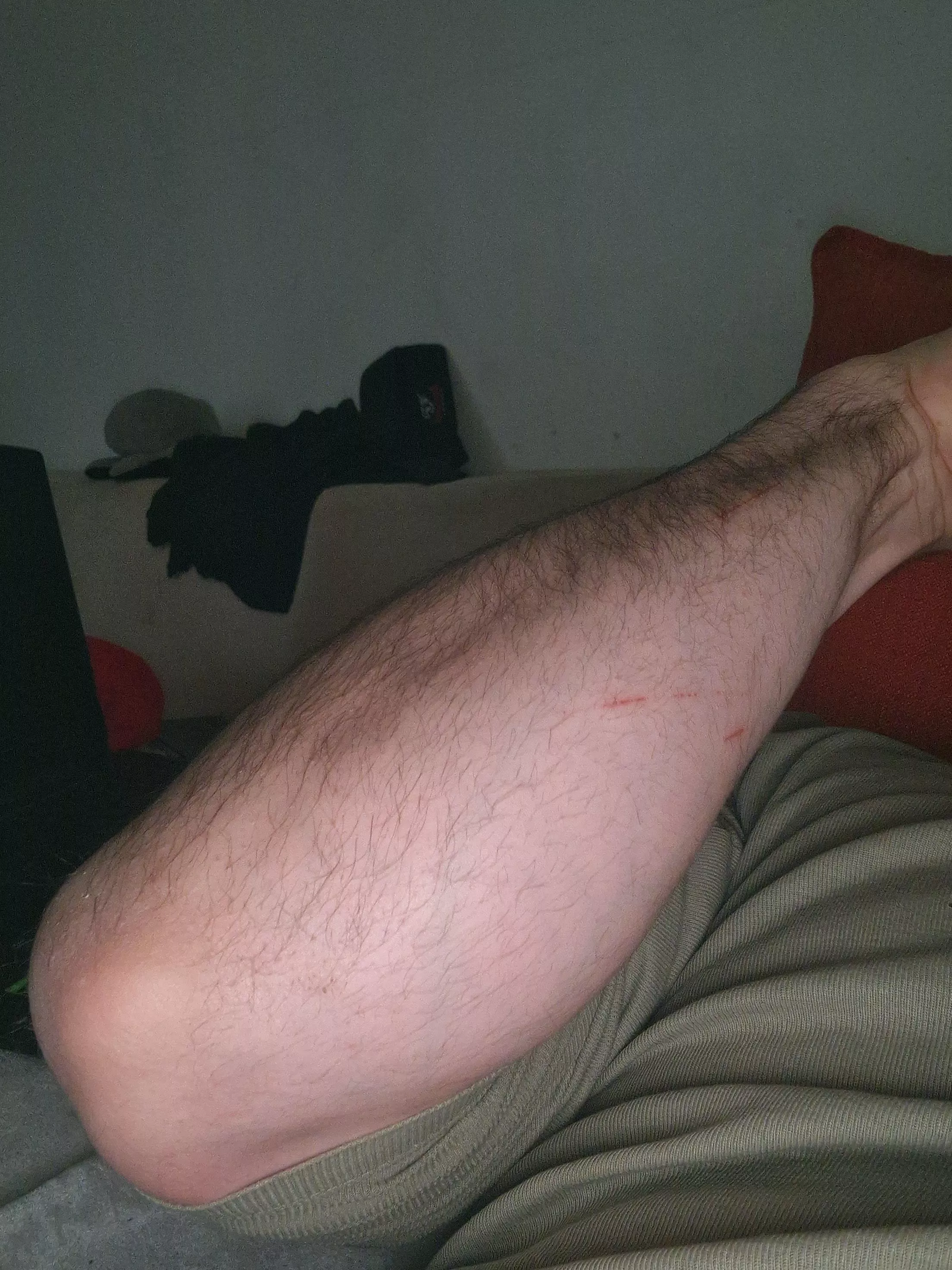 What do you think of my forearm