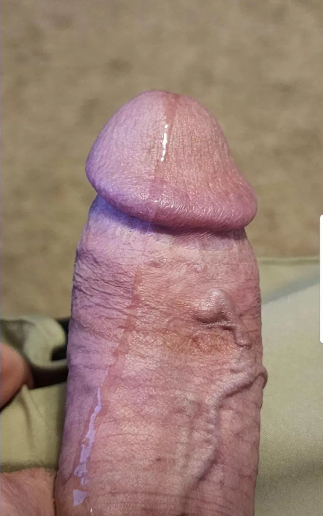 Anyone want to get hit with my poison arrow?